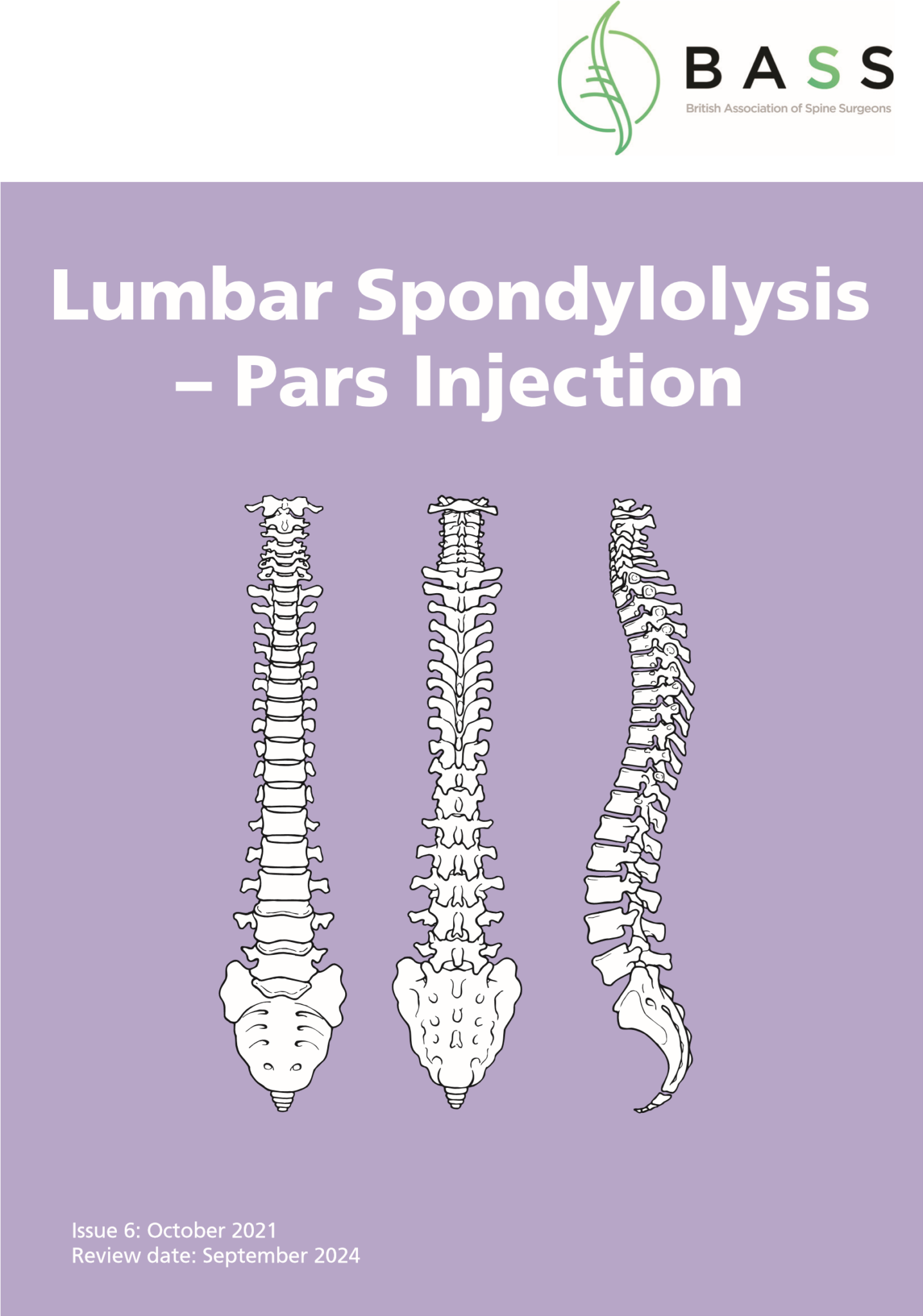 Pars Block Injection Pars Injection for Lumbar Spondylolysis - drpranawkumar.com