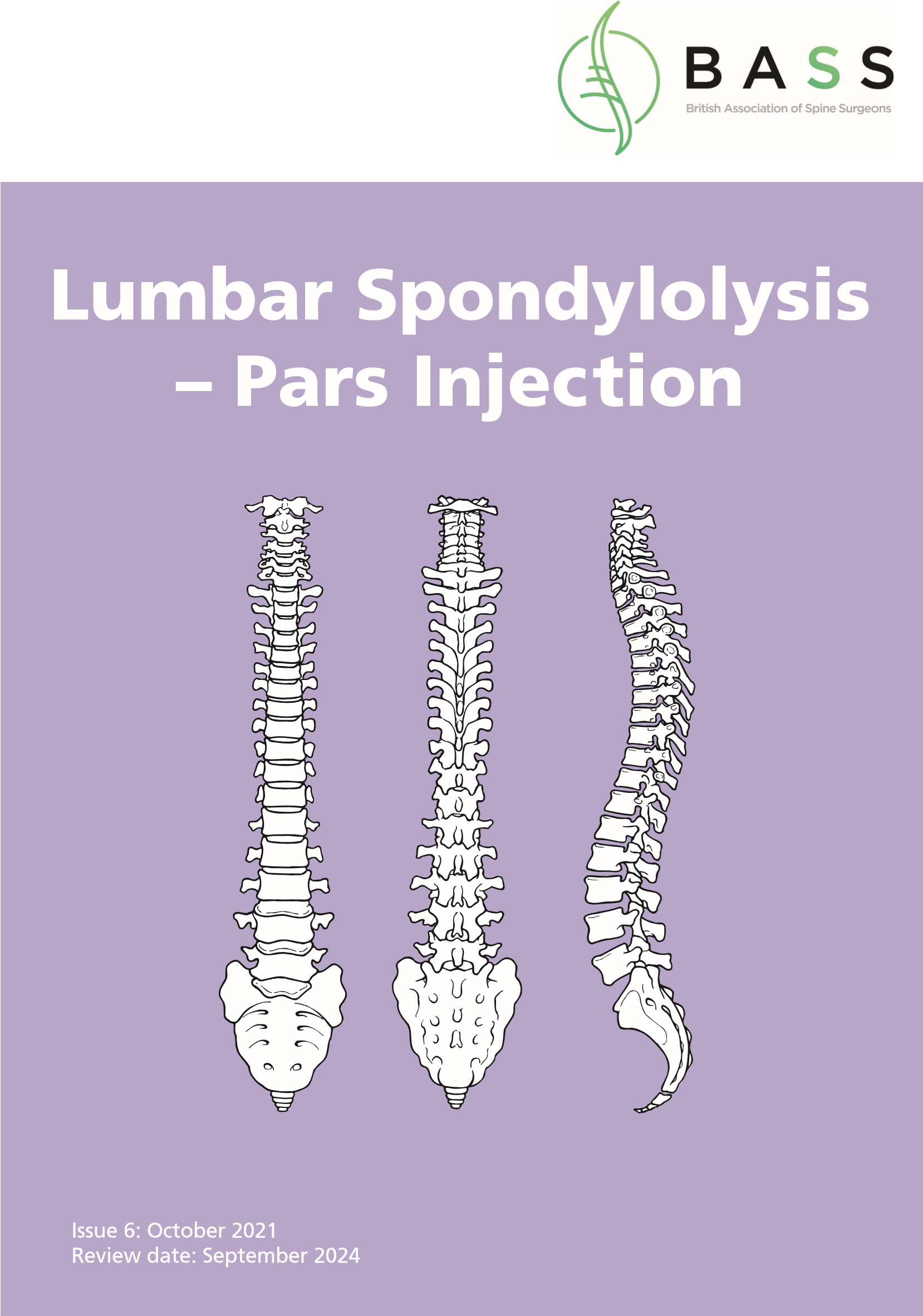 Pars Defect Injection Pars Injection for Lumbar Spondylolysis - drpranawkumar.com